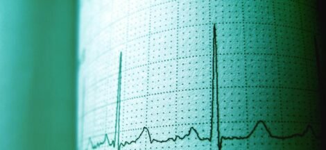 cbd effects on heart rate