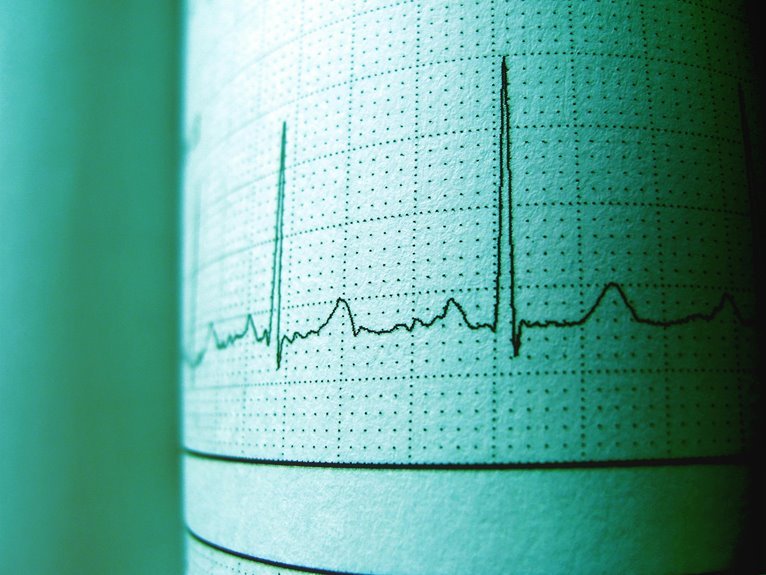 cbd effects on heart rate
