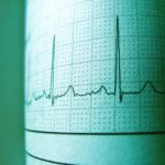 cbd effects on heart rate